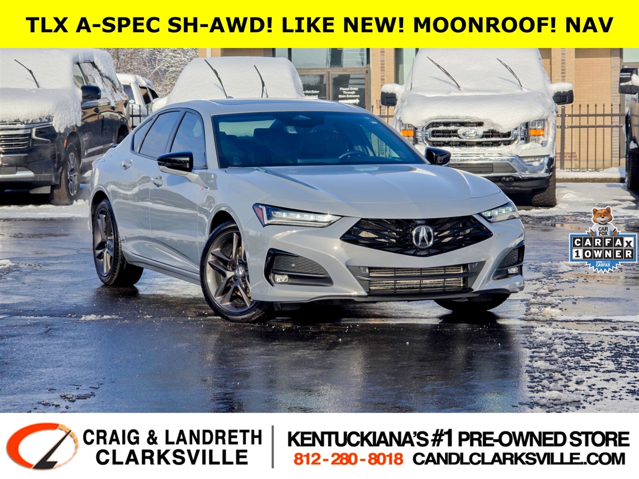 2025 Acura TLX A-Spec Package SH-AWD