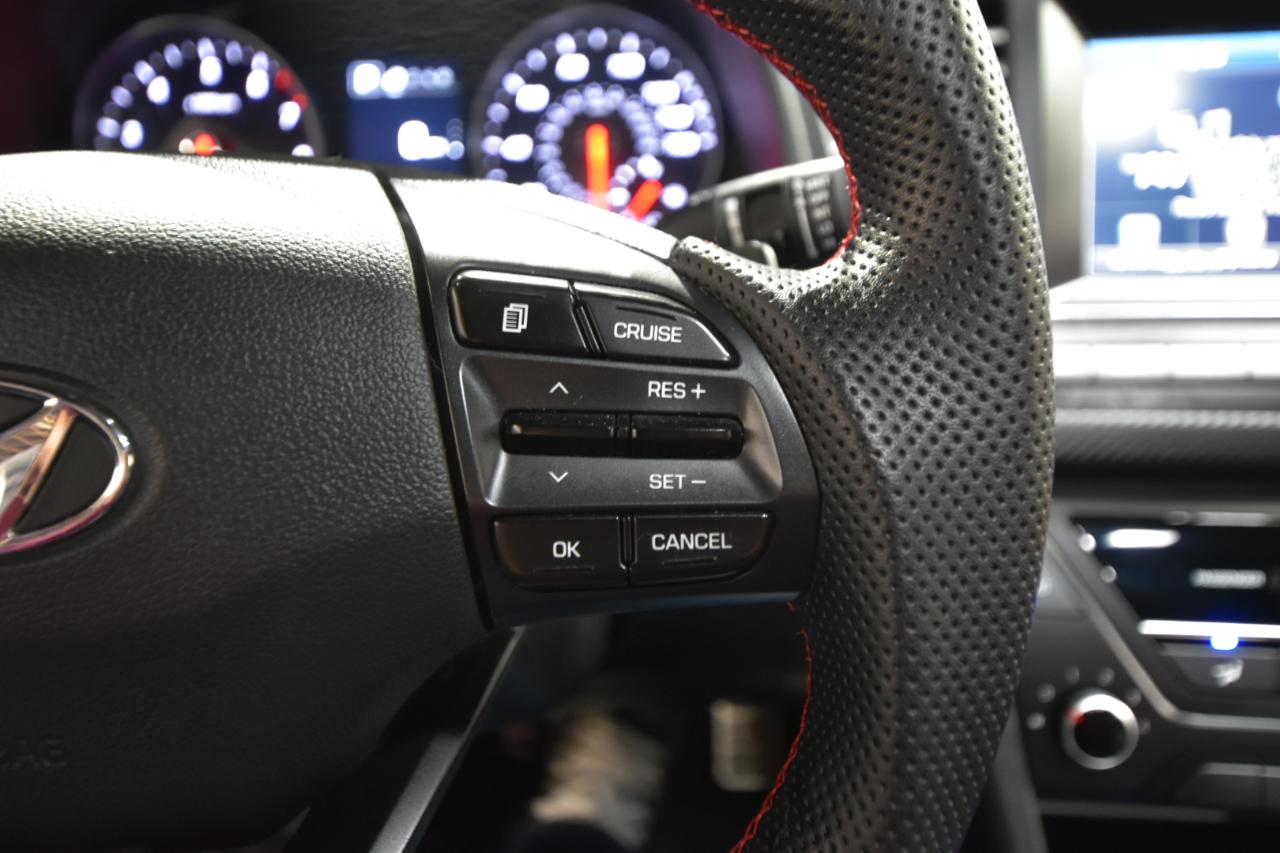 Hyundai Elantra Sport 1.6T Auto (Ulsan) 2017