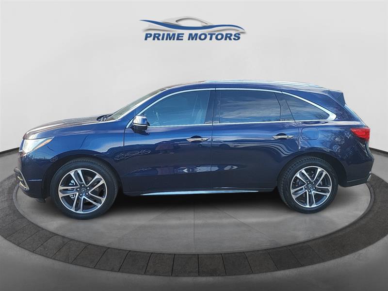 2017 Acura MDX Advance Package