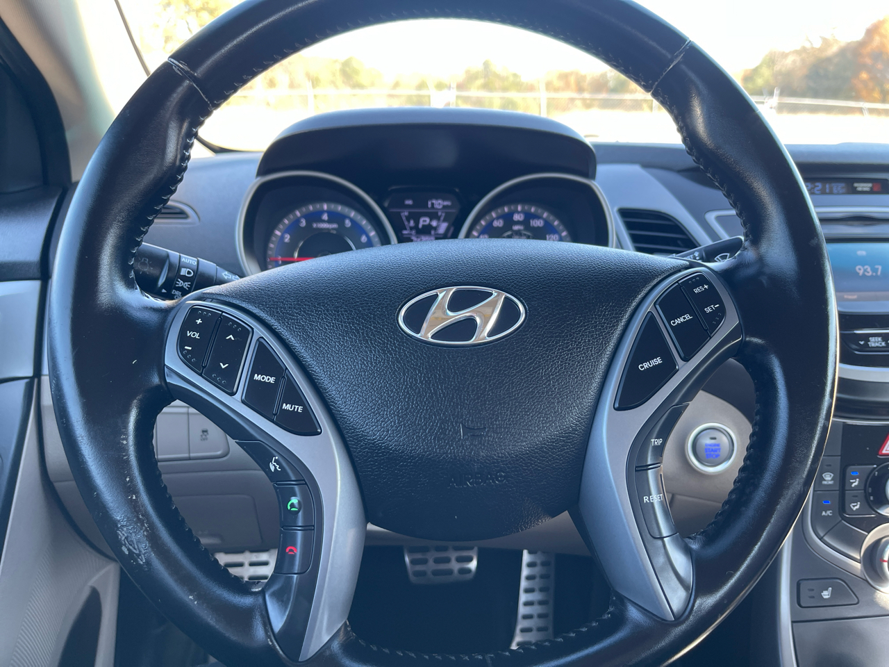 2015 Hyundai Elantra SE photo 3