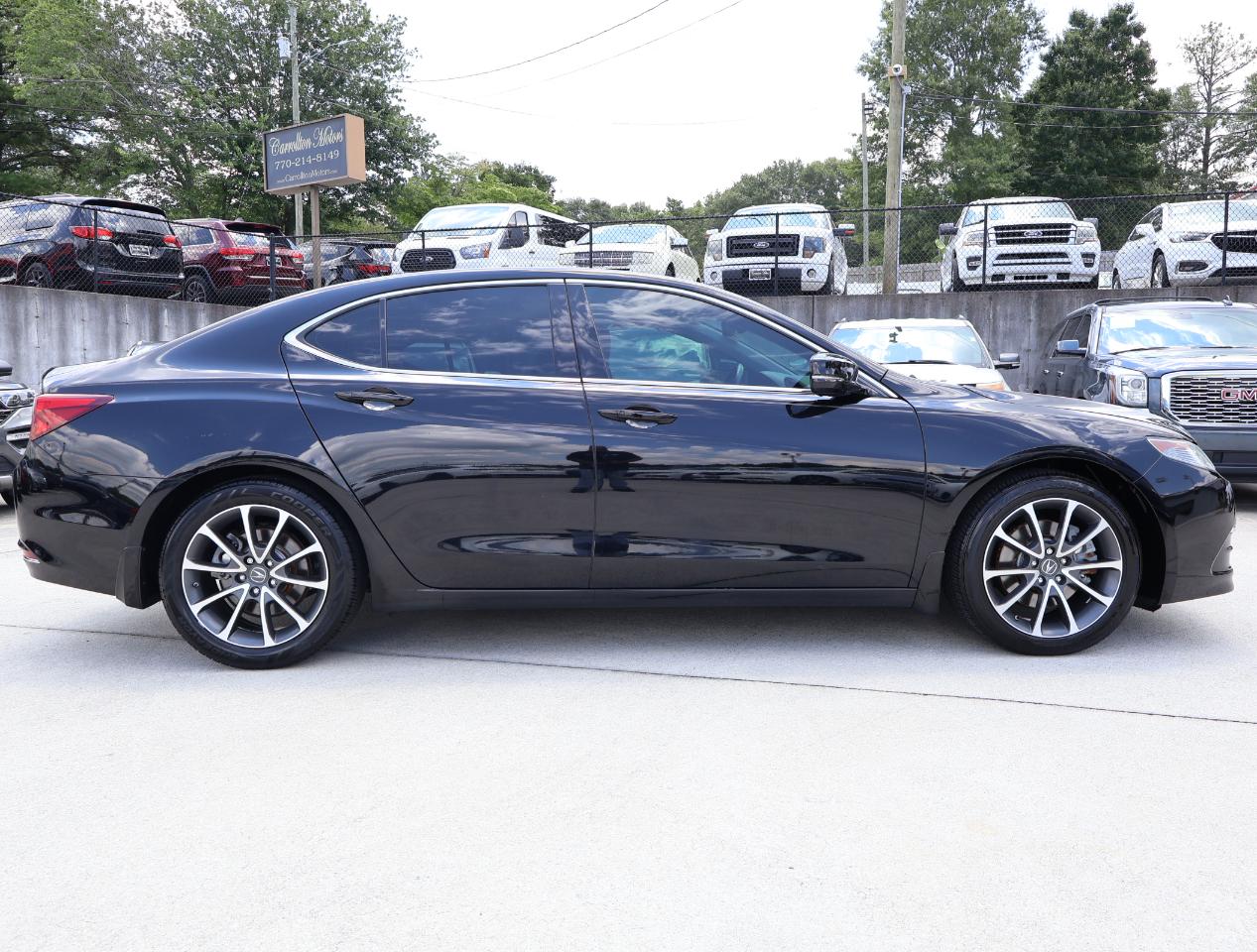 Acura TLX Technology Package 2015