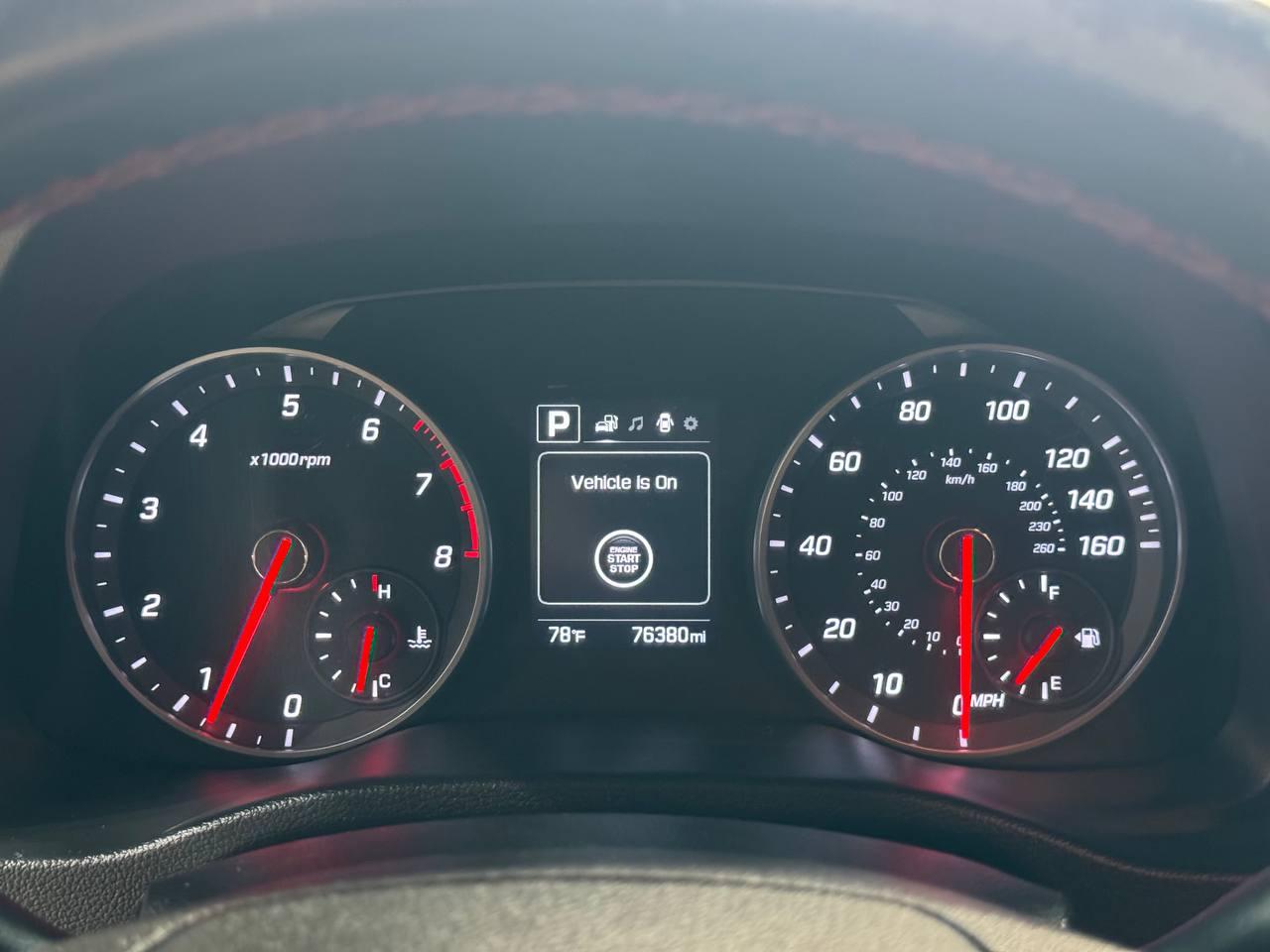 Hyundai Elantra Sport 1.6T Auto (Ulsan) 2018