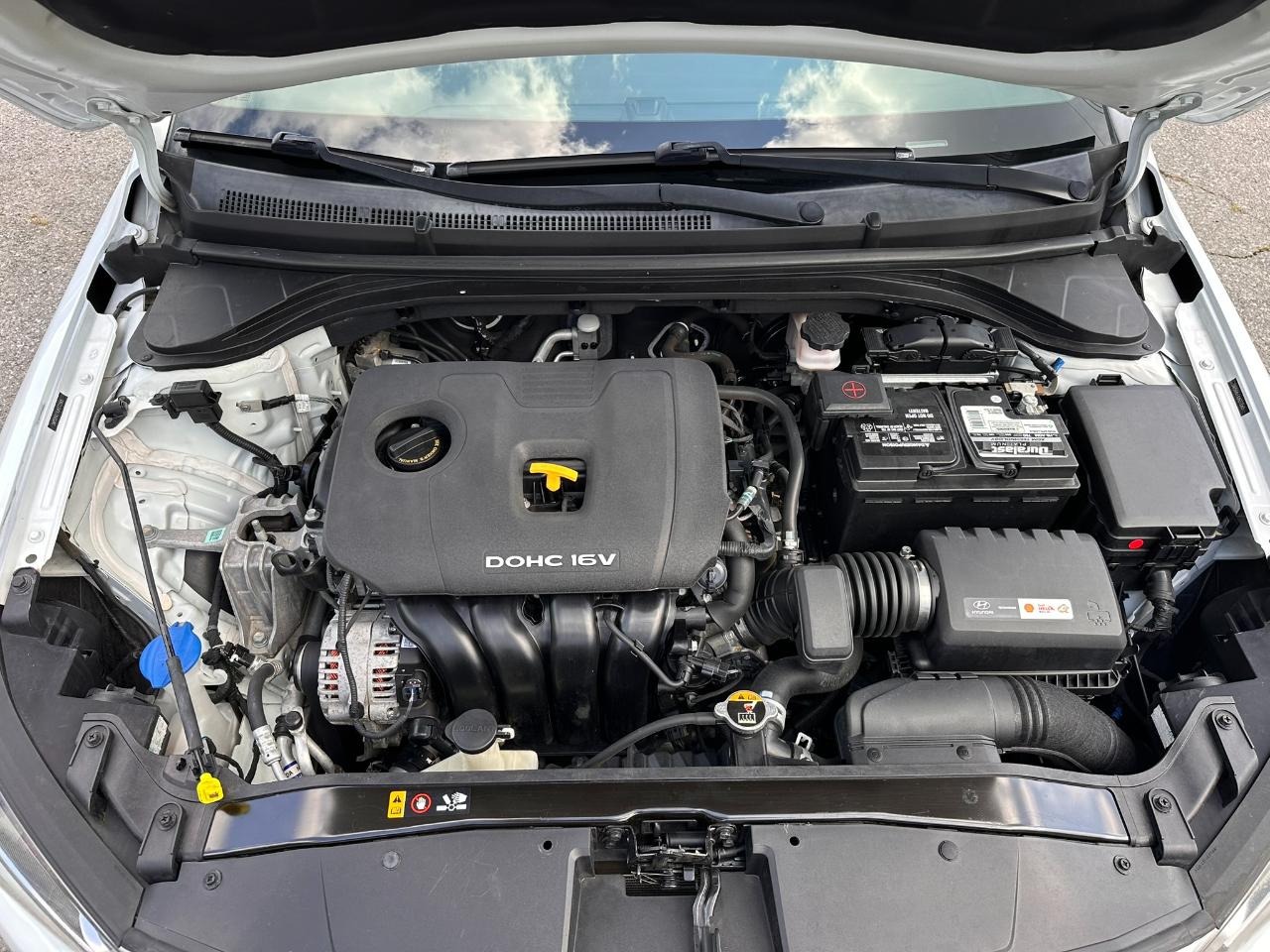 Hyundai Elantra Limited 2018