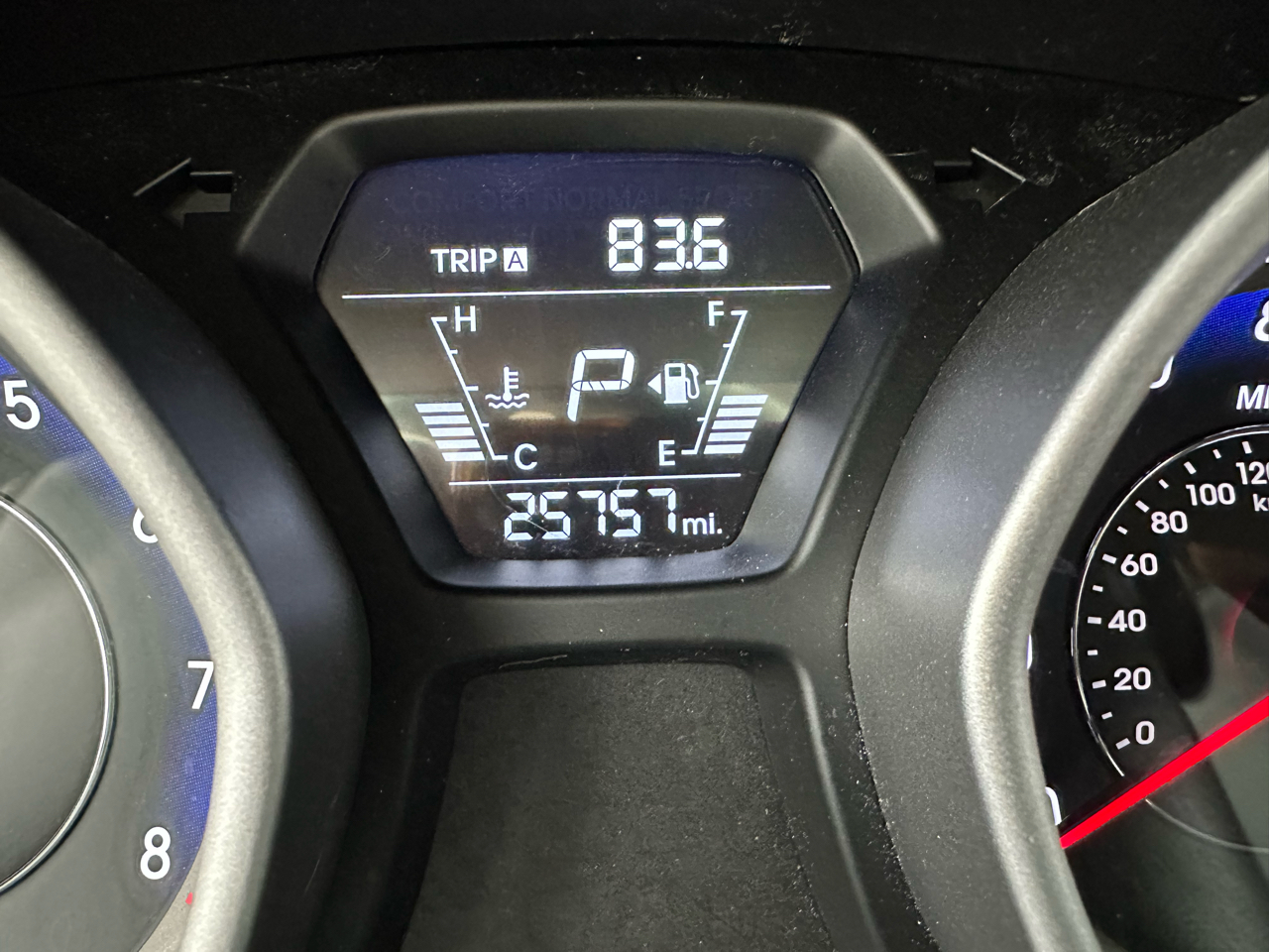 Hyundai Elantra SE 6AT 2016