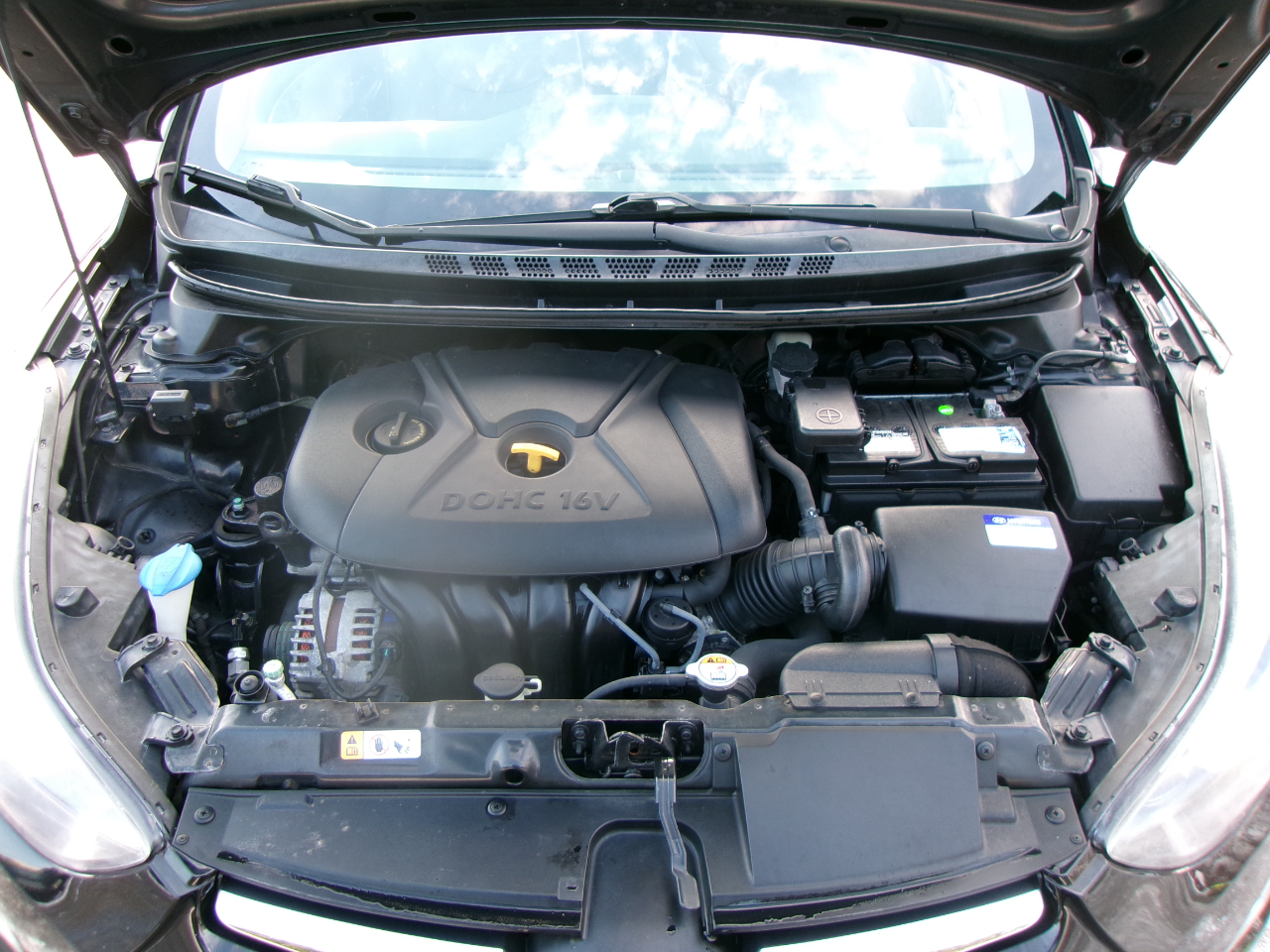 Hyundai Elantra SE 4D Sedan 2015