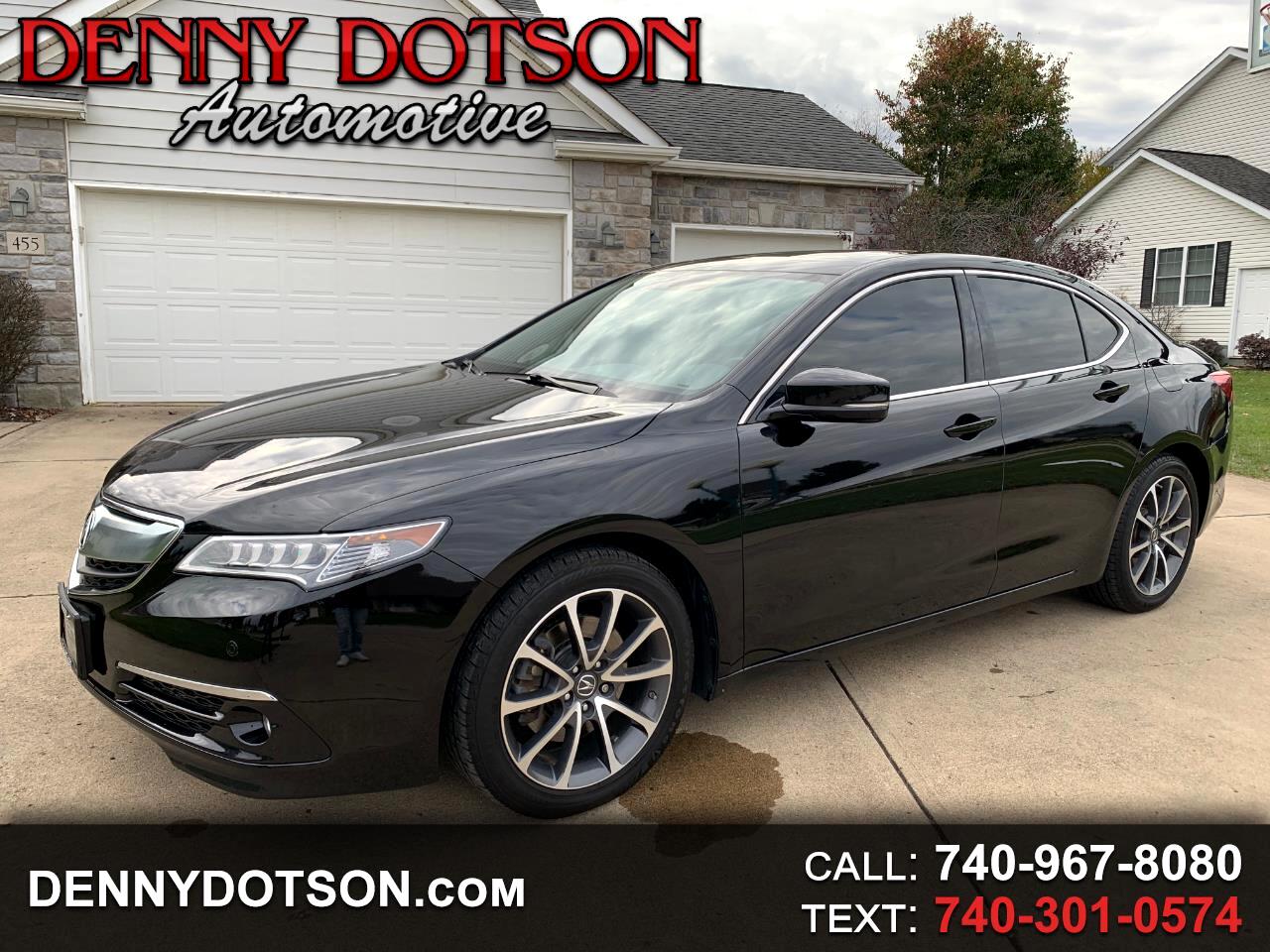 Acura TLX 4dr Sdn SH-AWD V6 Advance 2015