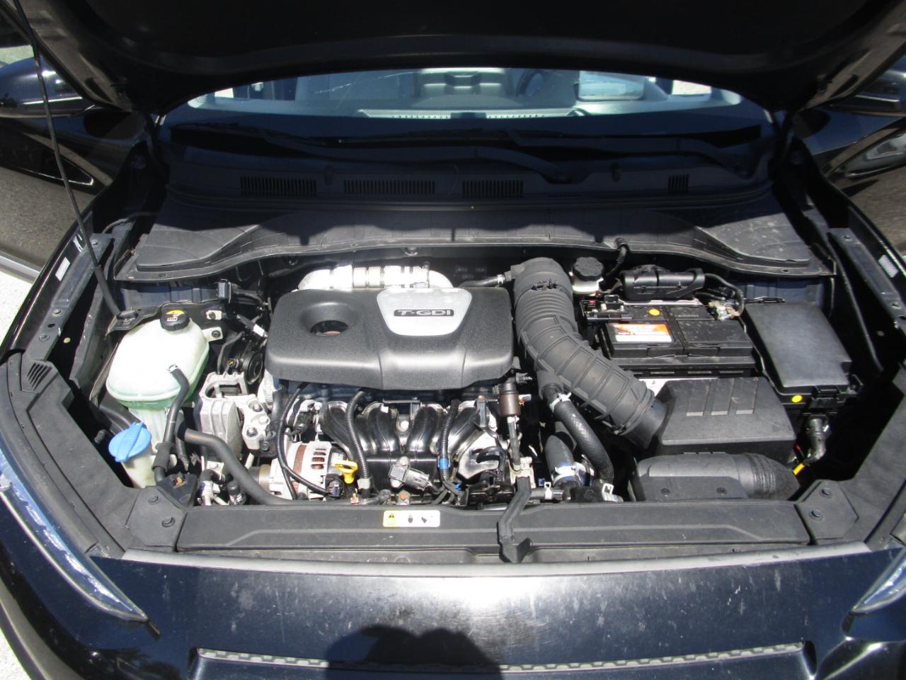 Hyundai Kona Ultimate 2018