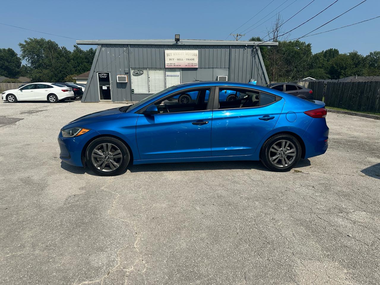 Hyundai Elantra Limited 2017