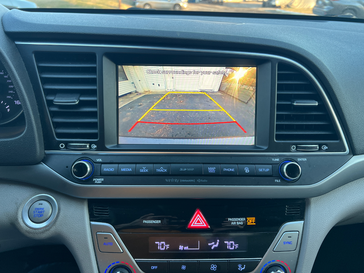 Hyundai Elantra Limited 2017