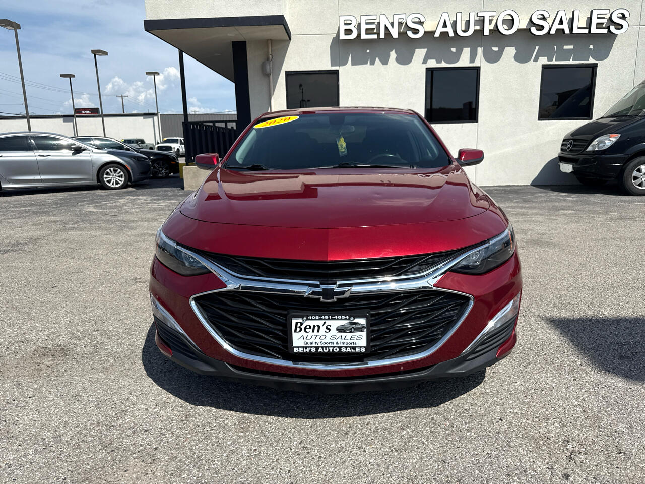 2020 Chevrolet Malibu RS photo 3