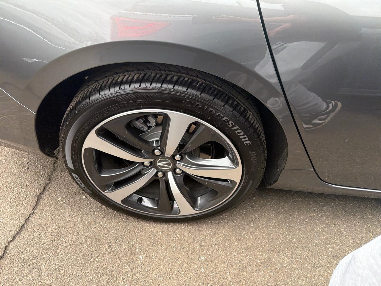 Acura TLX Technology Package 2025