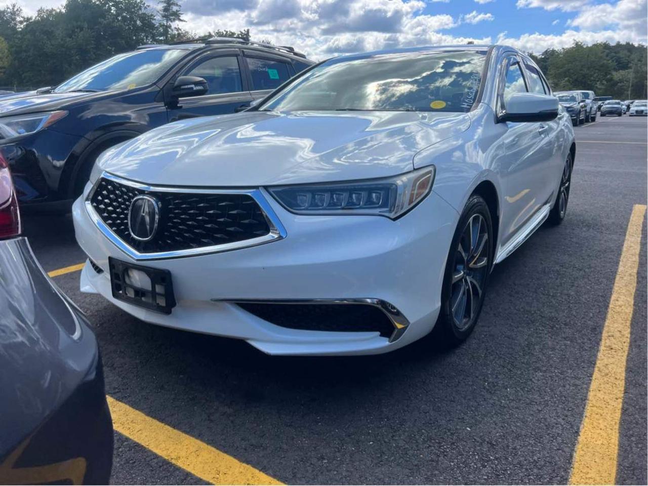 2018 Acura TLX TECH